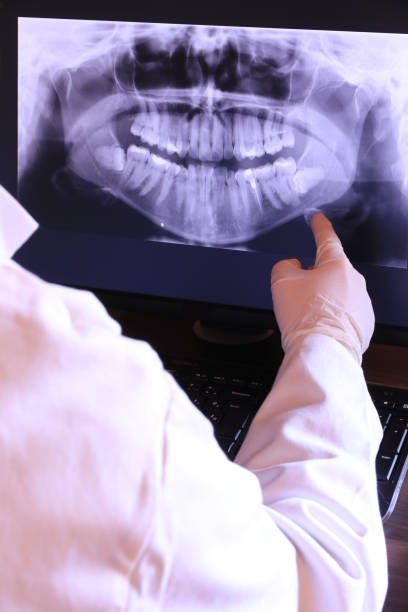 Best Emergency Dental Care for Sports Injuries in Hillburn, NY